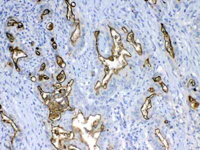 IHC - Anti-MUC1 Picoband Antibody ABO12811